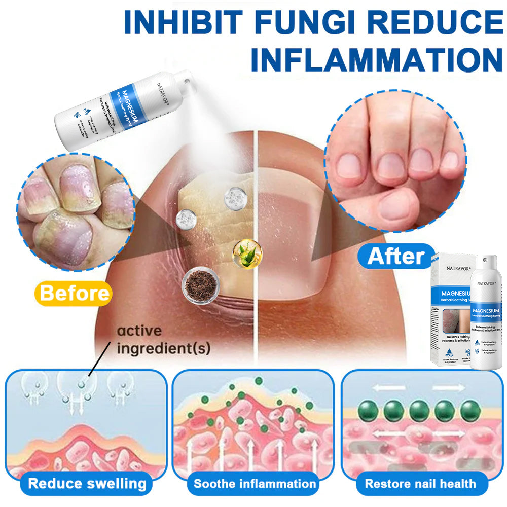 🔥 Natravor® Magnesium Spray – Fast Relief for Itchy, Red & Sensitive Skin (Even Intimate Areas)