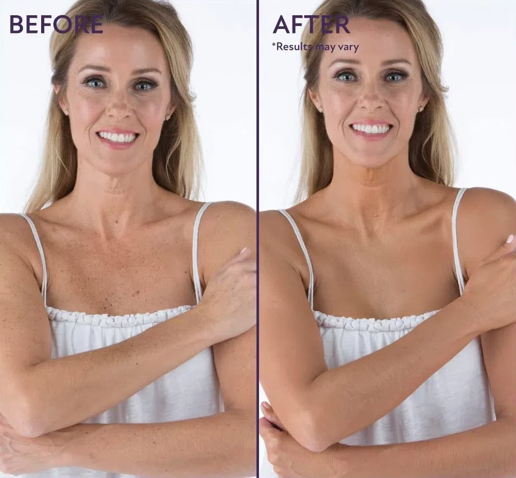 Natravor™ Body Coverage Perfector, All Over Complexion Perfecto, Waterproof and Sweatproof Leg Concealer, Cream Texture Conceals Blemishes, Evens Out Skin Tone,natural radiance