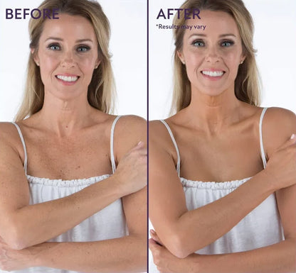 Natravor™ Body Coverage Perfector, All Over Complexion Perfecto, Waterproof and Sweatproof Leg Concealer, Cream Texture Conceals Blemishes, Evens Out Skin Tone,natural radiance