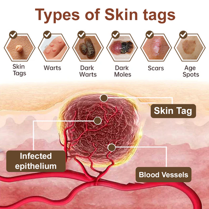 Natravor® Black Rice Skin Repair Essence Cream ⚕️ FDA Certified (Removes warts and skin growths, improves keratin buildup and seborrheic dermatitis, follicular keratosis, age spots, and bruising)