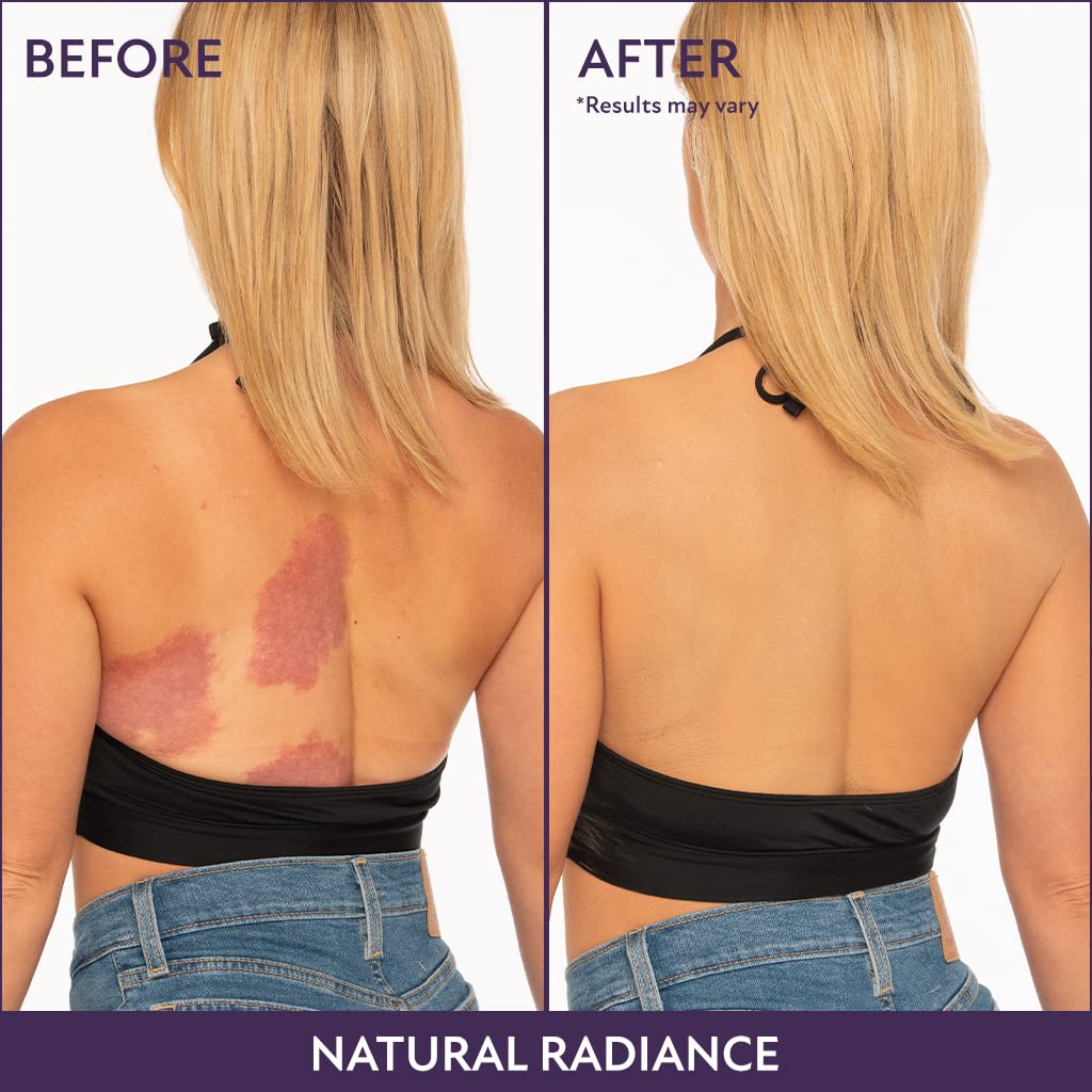 Natravor™ Body Coverage Perfector, All Over Complexion Perfecto, Waterproof and Sweatproof Leg Concealer, Cream Texture Conceals Blemishes, Evens Out Skin Tone,natural radiance